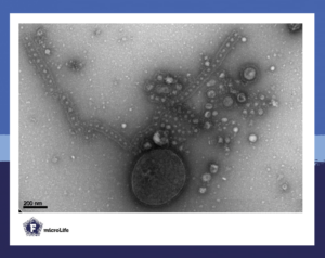 transmission electromicroscopic image of archaeal membrane vesicles