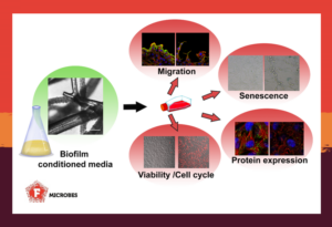 workflow to analyse how bacterial biofilms impact wounds healing