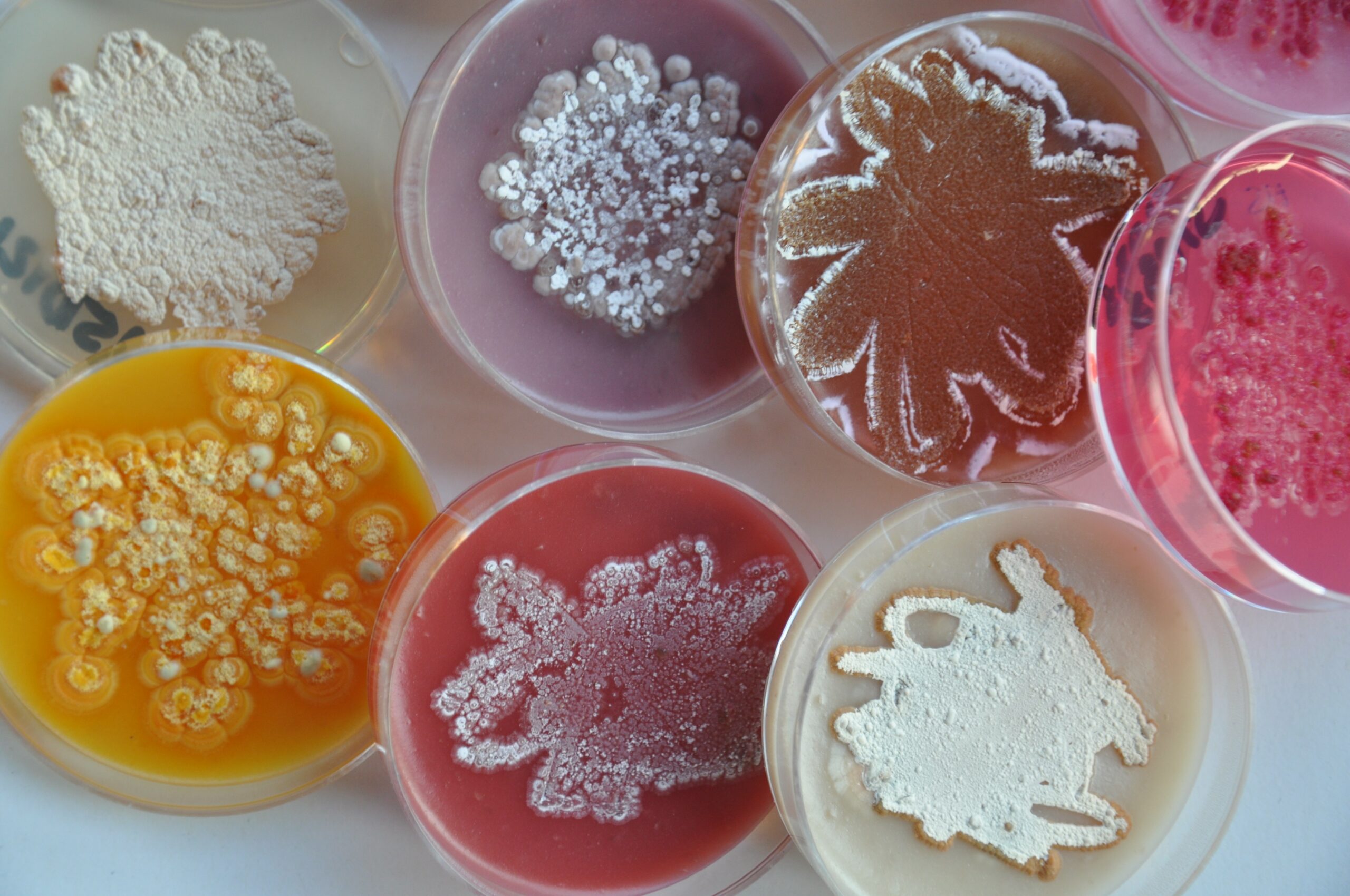 Several Petri dish with different coloured microorganisms