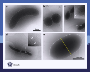 Cry-electron microscopy show that microbes of the core microbiome span a plethora of morphologies