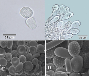 Melampsora himalayensis urediniospores (left) and praphyses (right).